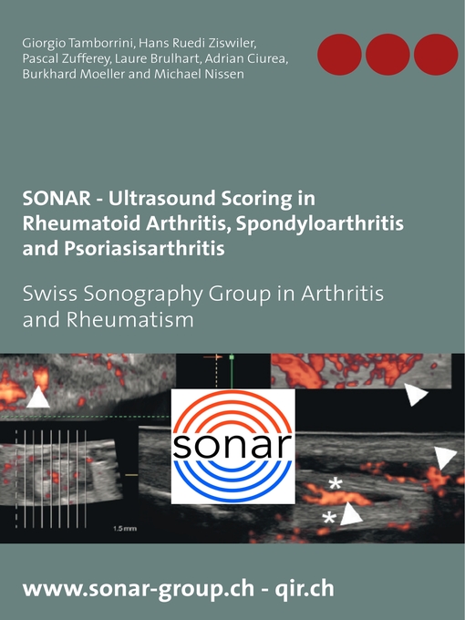 Title details for SONAR--Ultrasound Scoring in Rheumatoid Arthritis, Spondyloarthritis and Psoriasisarthritis by Giorgio Tamborrini - Wait list